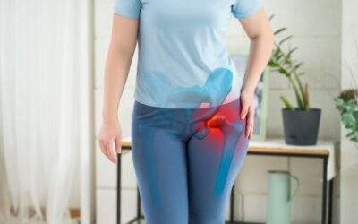 ¿Qué es la bursitis trocantérica?