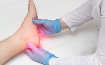 ¿Qué es la fascitis plantar?